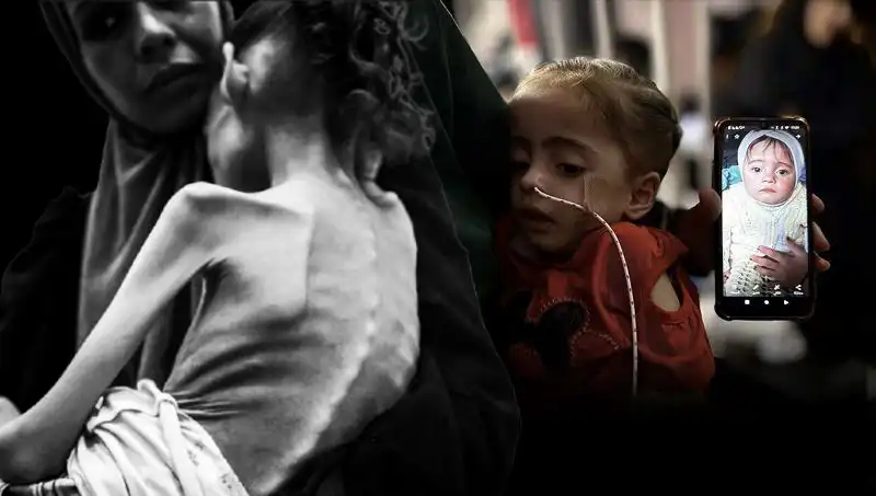 Küçük Meryem’in Hikayesi: Açlıkla Mücadelede 15 Kiloluk Düşüş