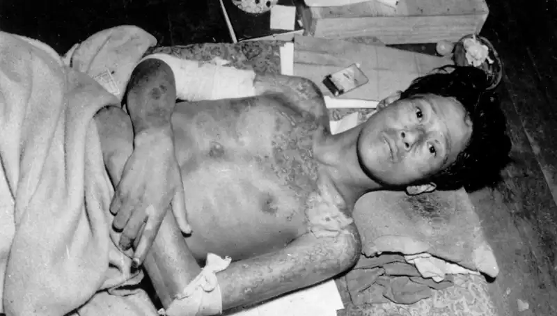 80 Yıl Sonra Nagasaki’den Uyarı: Nükleer Felaket Penceremiz Daralıyor