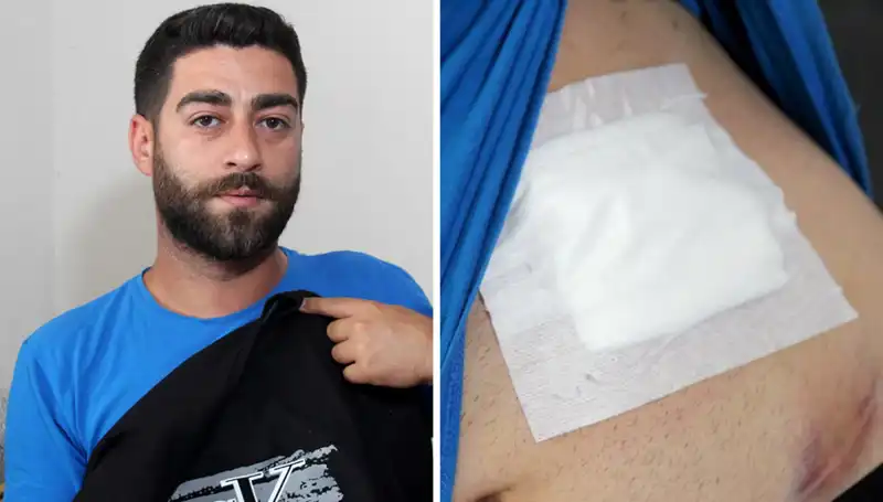 Karnındaki Ağrının Sebebi Röntgende Ortaya Çıktı: Şaşkınlık Verici Sonuçlar