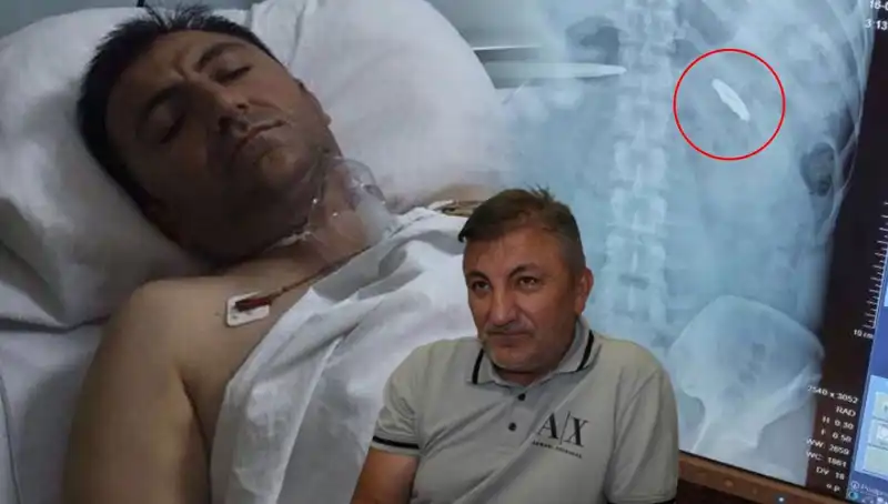 15 Temmuz'un Bir Unutulmuş Kahramanı: Vücudunda Kurşunla 9 Yıldır Mücadele Eden Adam