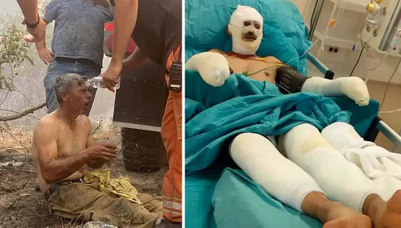 Ormanda Korkunç Yangın: Yanıyorum Diye Feryat Eden İşçiye Acil Müdahale