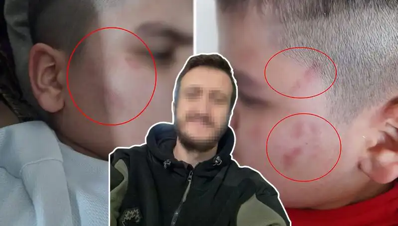 Okulda Otizmli Çocuğa Yapılan Saldırı: Aile Tepkili